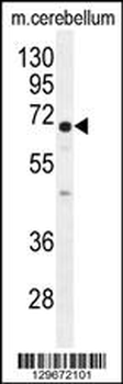 UGT8 antibody (Center)