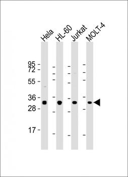 OPN-a/b Antibody (N-term)