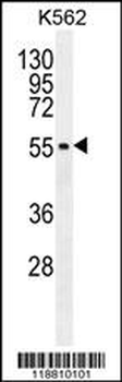 MITF Antibody (N-term)