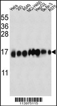 Interferon-inducible protein (IFITM3) Antibody (N-term)