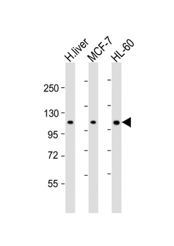 RSBN1 Antibody (N-term)