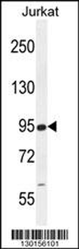 RSBN1 Antibody (N-term)