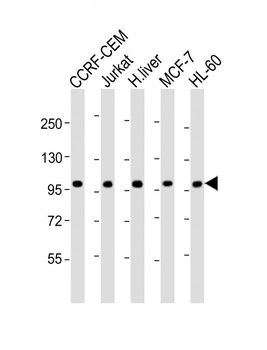 RSBN1 Antibody (N-term)