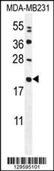 MIA40 Antibody (C-term)
