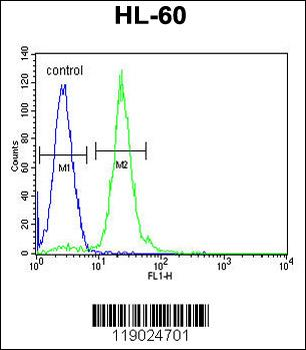 CPT1C Antibody (C-term)