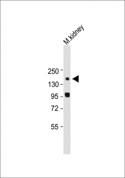 COL4A2 Antibody (N-term)