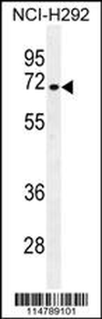 NUMB Antibody (N-term)