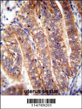 NUMB Antibody (N-term)
