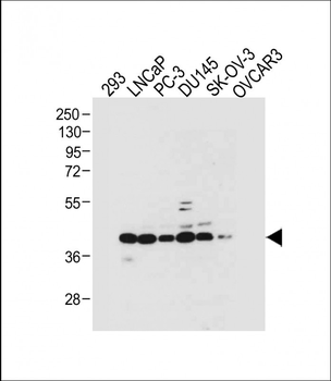 STRA8 Antibody (C-term)