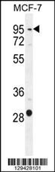 PTCHD3 Antibody (C-term)
