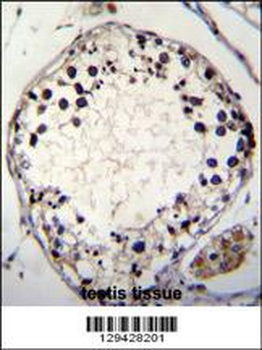 PTCHD3 Antibody (C-term)