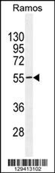 TSGA10IP Antibody (C-term)
