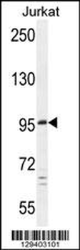 PTCHD4 Antibody (Center)