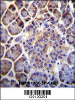 PTCHD4 Antibody (Center)