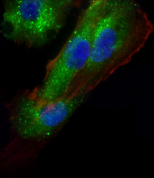AP1M1 Antibody (Center)