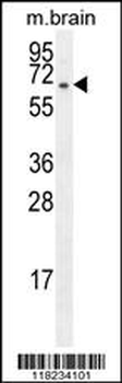 FBXO21 Antibody (C-term)