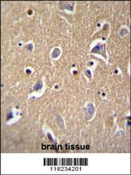 FBXO21 Antibody (C-term)