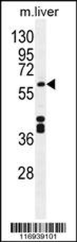 CYP1A2 Antibody (Center)