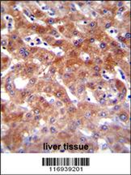 CYP1A2 Antibody (Center)