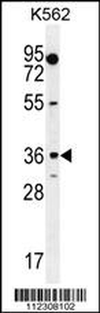 MOGT1 Antibody (C-term)