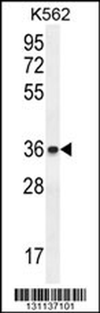 ETV2 Antibody (N-term)