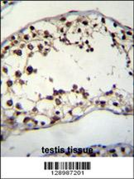 PIH1D2 Antibody (C-term)