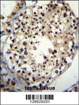 ALKBH6 Antibody (Center)
