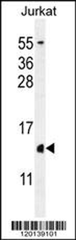H2AFZ Antibody (C-term)
