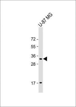 GGH Antibody (N-term)