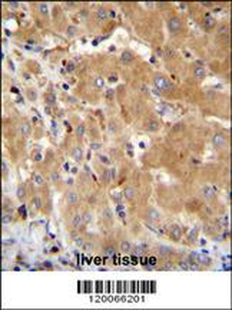 GGH Antibody (N-term)