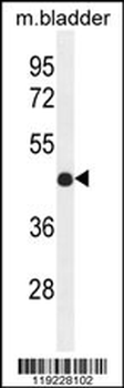 IRF2 Antibody (Center)