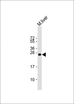 IGF2 Antibody (Center R54)