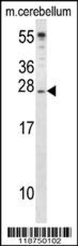 IGF2 Antibody (Center R54)