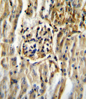 CYP11B2 Antibody (Center)