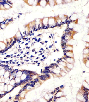 CYP11B2 Antibody (Center)