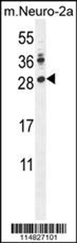 LIN28A Antibody (Center)