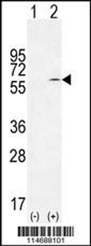 TIEG Antibody (Center)
