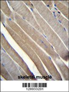 TRMT2B Antibody (N-term)