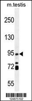 IFT88 Antibody (C-term)