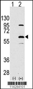 ELP3 Antibody (N-term)