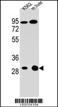 ETFA Antibody (C-term)