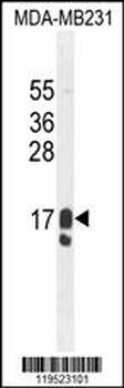 GCDFP-15 Antibody (C-term)