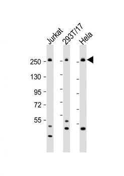 CAD Antibody (Center)