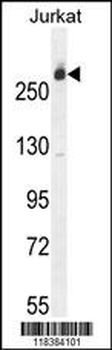 CAD Antibody (Center)