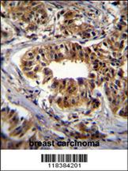 CAD Antibody (Center)