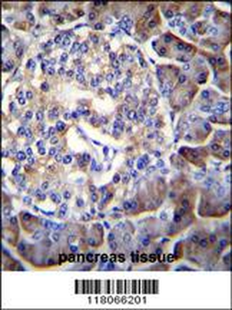 HIP1R Antibody (N-term)