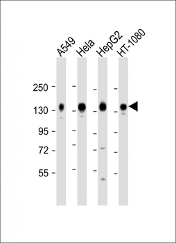 CD130 Antibody (C-term)