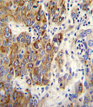 CYP2B6 Antibody (Center)