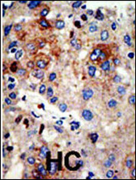 HDAC9 Antibody (N-term)