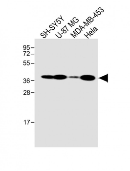 GFRAL Antibody (C-term)